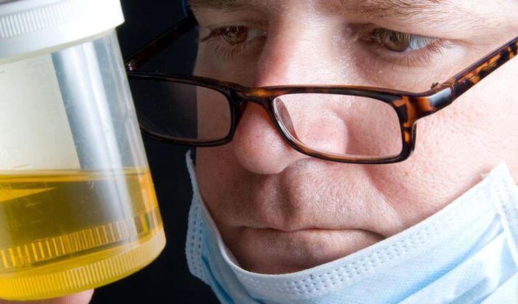 Urinalysis for chronic prostatitis